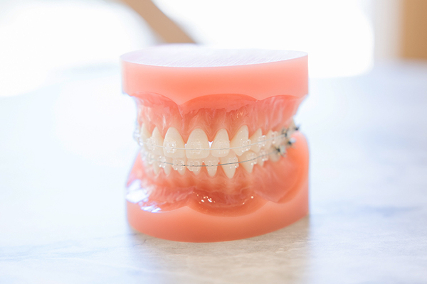 広瀬杏里院長 天神AN矯正歯科5