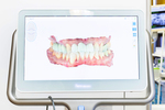 医療法人 TERRA矯正歯科クリニック 佐賀市 患者の負担軽減のため、口腔内スキャナーを導入している