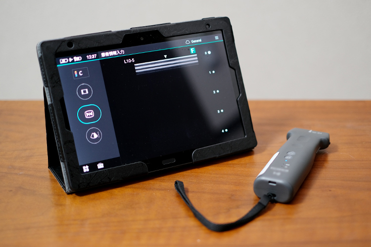 ホームケアクリニック田園調布 大田区 携帯型の超音波検査装置