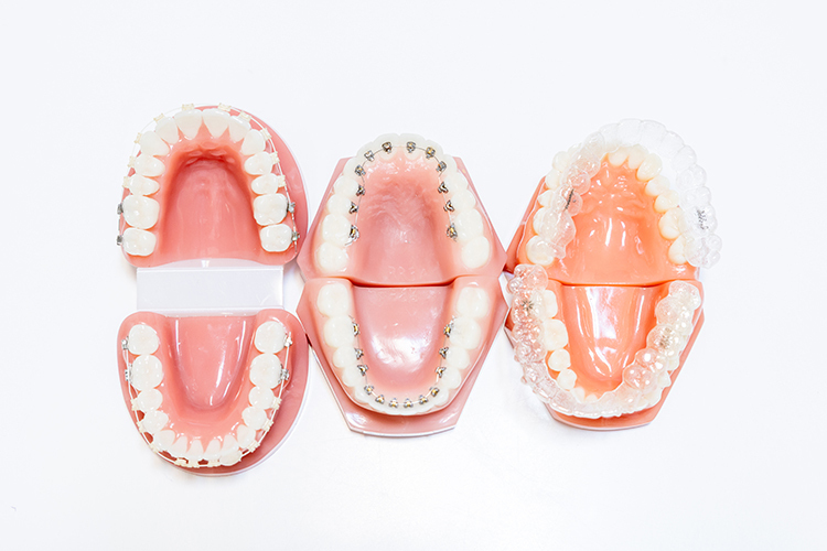 医療法人 TERRA矯正歯科クリニック 佐賀市 さまざまな矯正方法に対応している