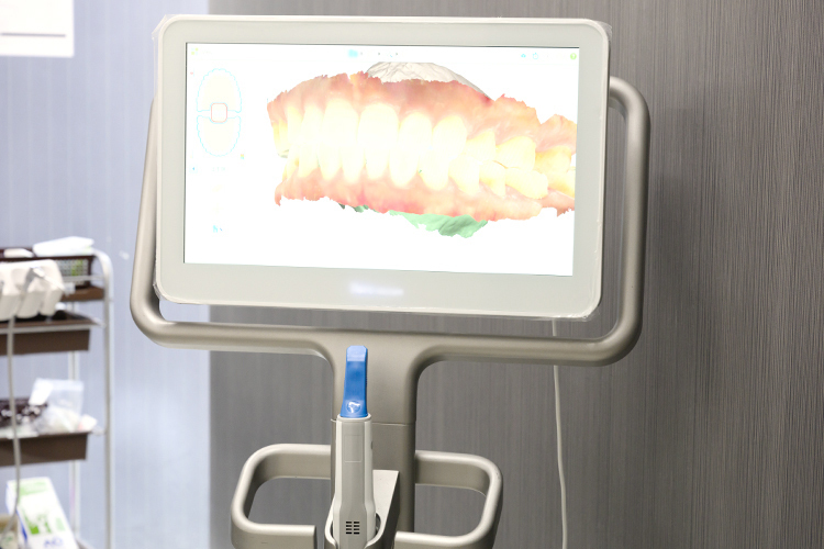 GNデンタルクリニック 新宿区 口腔内スキャナーで視覚的によりわかりやすく説明