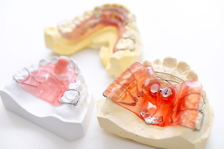 ゆずり葉歯科 中央区 小児矯正も対応。口腔内の状況に合わせた装置を提案する