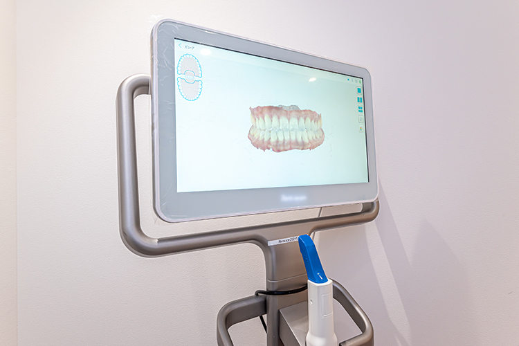 秋岡デンタルクリニック 福岡市南区 先進の口腔内スキャナー完備