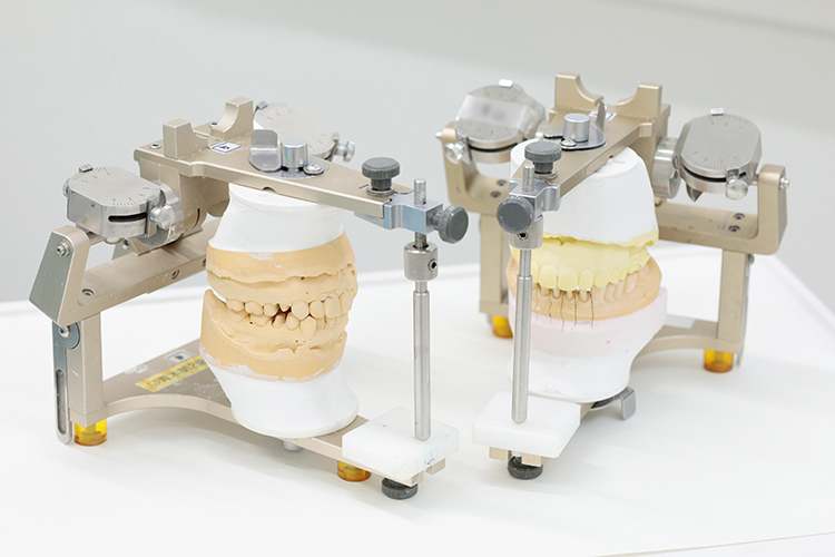 青木第二歯科医院 新宿区 咬合器を用い、噛み合わせを重視した治療を行う
