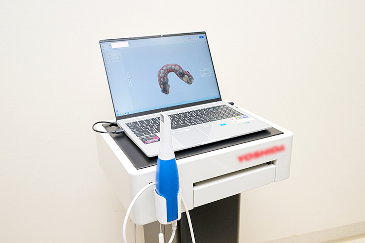 おちあい歯科クリニック 目黒区 患者への負担が少ない、口腔内スキャナーも導入