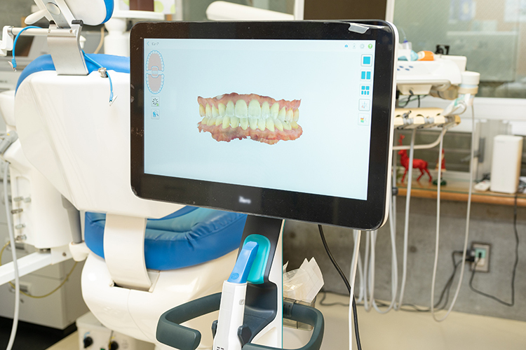福嶋歯科医院 多摩市 口腔内3Dスキャナーも完備し、クオリティー重視の治療を提供
