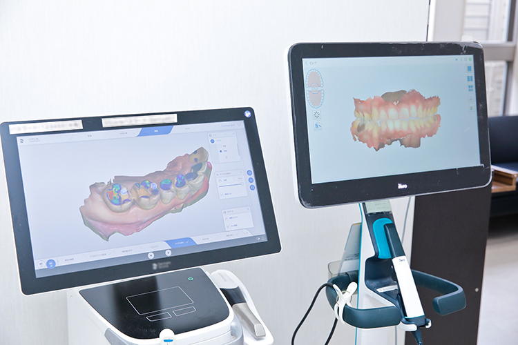まつのき歯科クリニック 古河市 3D口腔内スキャナーなど各種先進の検査機器を導入している