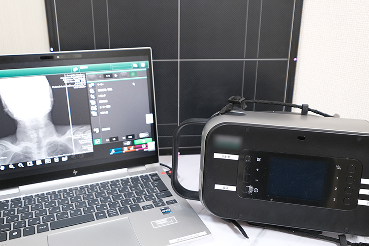 葛西ホームケアクリニック 江戸川区 ポータブルレントゲンも活用