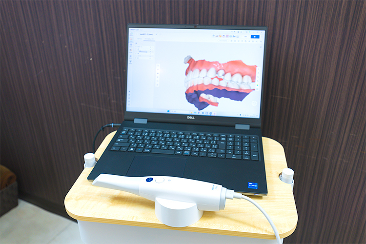 祐天寺歯科クリニック 目黒区 患者の負担を軽減し、より精密な治療ができる口腔内スキャナー