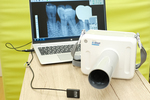 くす乃歯科オーラルケアクリニック 福岡市博多区 治療の精度を上げるため歯科用ポータブルレントゲンも使用