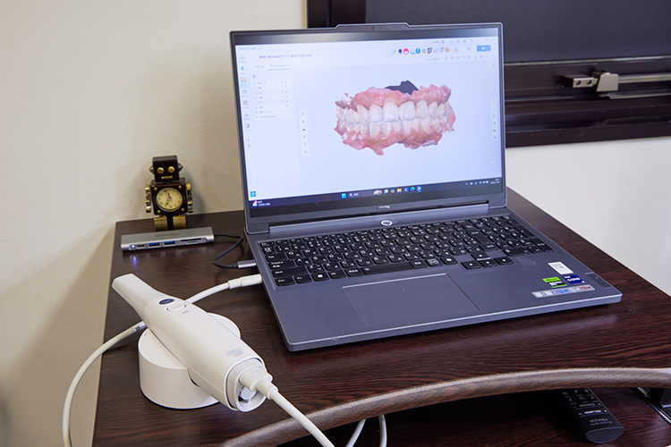 ワイズデンタルオフィス 町田市 口腔内スキャナーで視覚的によりわかりやすく説明