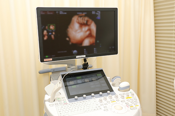 胎児の動きがよくわかる超音波4Dエコー 5