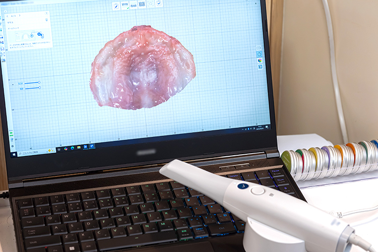 こどもの歯科 目黒区 口腔内3Dスキャナーで生後すぐから口腔内の状態を確認する