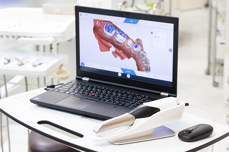 きのした歯科クリニック 横浜市南区 患者の負担が少ない口腔内スキャナー