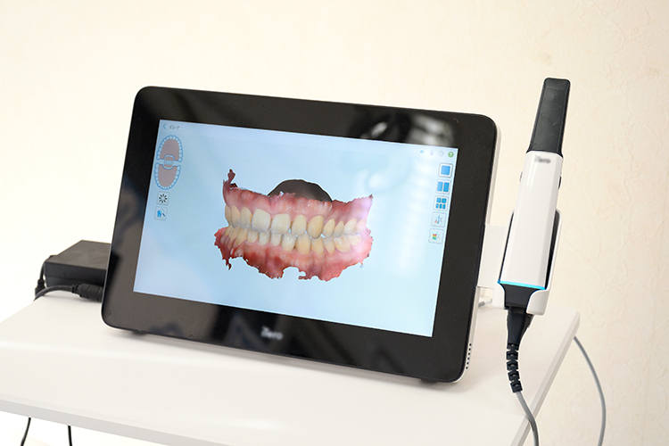 海岸歯科Oral Care 千葉市中央区 口腔内スキャナー。患者への説明時、理解を促すのに役立てている