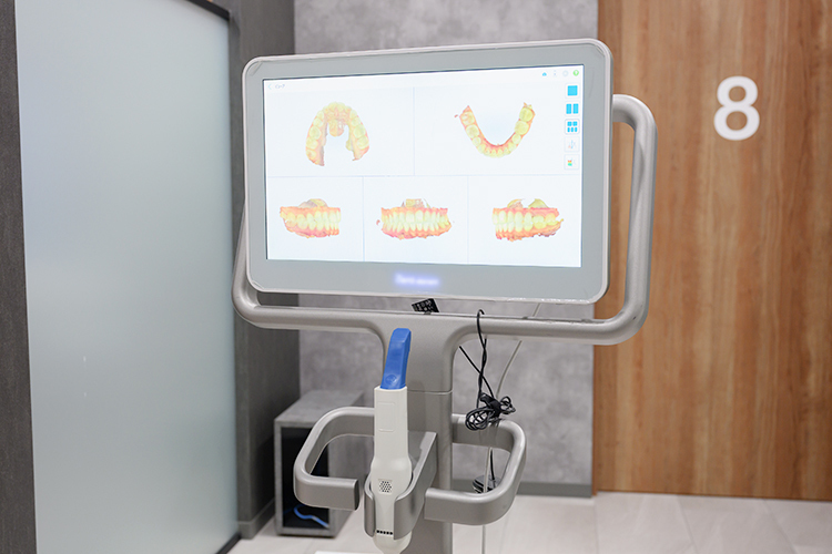 スター歯科 佐倉市 口腔内スキャナーをはじめとした各種設備がそろう