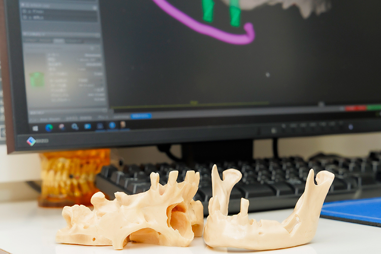 興福歯科医院 名古屋市中村区 歯科用CTや口腔内スキャナーを用いて精密に設計
