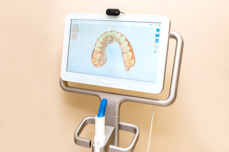 久米おとなこども歯科 神戸市長田区 矯正や補綴物作製を行う際に活用する口腔内スキャナー