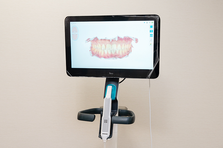 新宿スワン歯科・矯正歯科 新宿区 歯並びのデータを採りシミュレーションを行う口腔内スキャナー