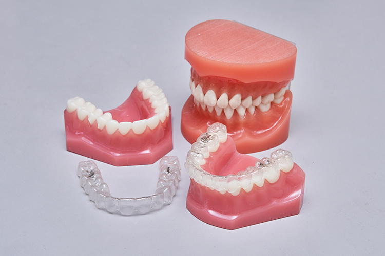 のむら歯科・矯正歯科 四條畷市 マウスピース型装置を使った矯正を提供