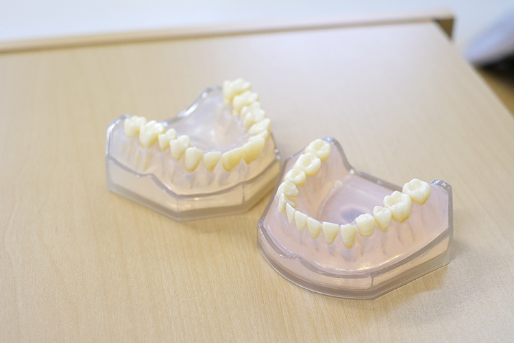 福泉歯科医院 福岡市中央区 一人ひとりの状態に合わせた入れ歯の作製や調整も行う