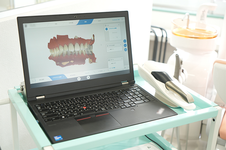 湘南六会歯科クリニック 藤沢市 歯並びのデータを取りシミュレーションを行う口腔内スキャナー