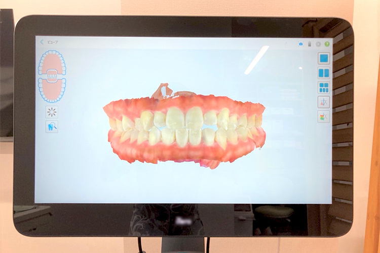 のぞみ歯科クリニック　こども矯正歯科室 中頭郡北中城村 幼少期からの口腔育成に注力している