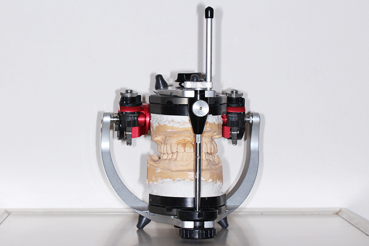 稲川歯科医院 横浜市青葉区 噛み合わせの診断や、入れ歯・かぶせ物等の作製に用いる咬合器