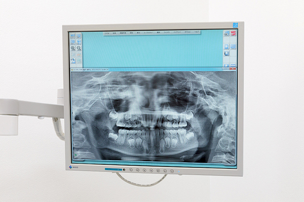 高端デンタルクリニック 矯正計画を立てるために、検査・診断