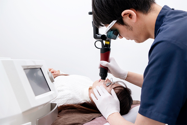 上野御徒町ファラド皮膚科 レーザー治療