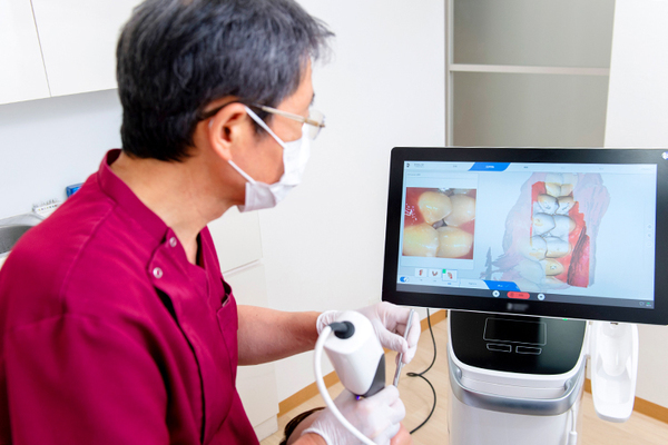 江本歯科 口腔内スキャナーで型採りをする