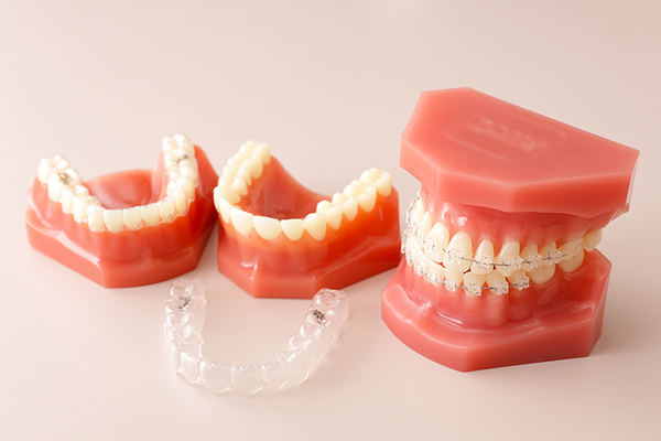 豊中服部ノボ歯科・矯正歯科クリニック 歯列矯正がスタート