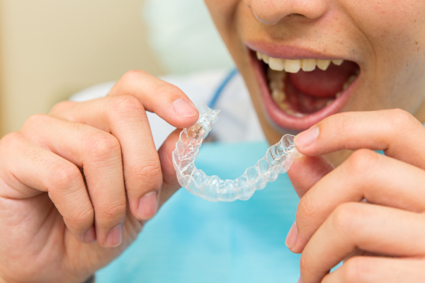 アーク杉並デンタルクリニック マウスピース型矯正を製作して矯正治療を開始