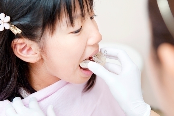 あさひ矯正歯科医院 1期矯正の開始