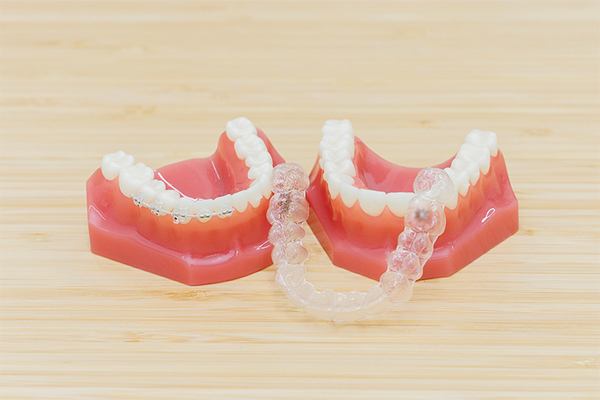 志賀本通たくみ歯科・矯正歯科 矯正がスタート