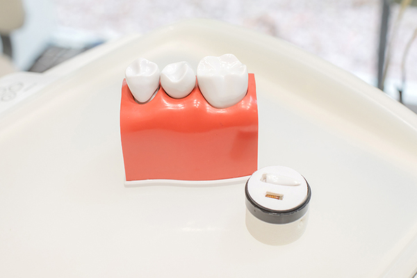 あゆみ歯科クリニック松井山手 かぶせ物をつける