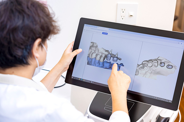 SEIJO PRIME DENTAL OFFICE 仮歯の装着