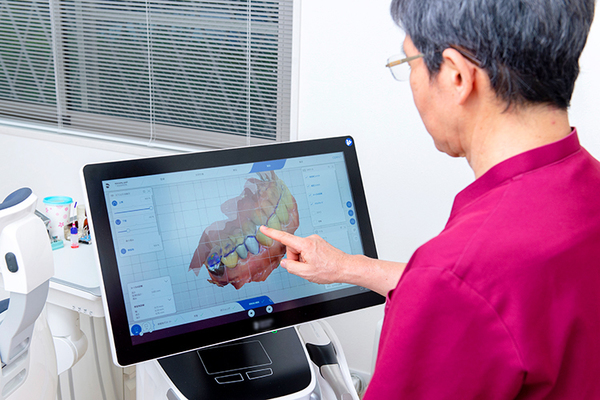 江本歯科 取り込んだデジタルデータをもとに修復物を製作