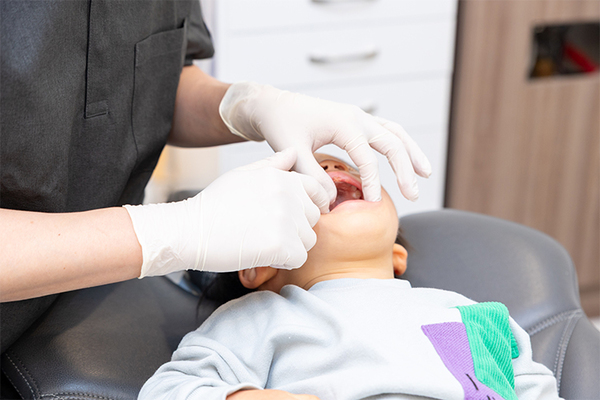 くりさき歯科 矯正後のメンテナンス