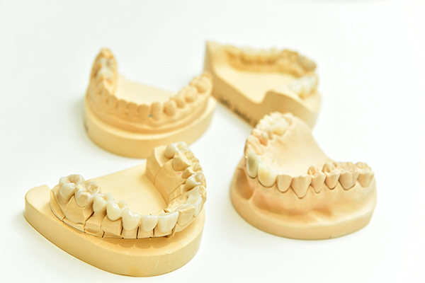 くろさわ歯科医院 患者の希望を大切にする審美歯科 歯科技工士との連携で精度向上を