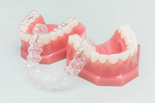 体の健康も視野に入れた矯正 マウスピース型装置を用いた矯正