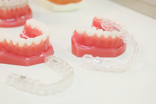 見た目だけでなく機能面にも配慮 マウスピース型装置を用いた矯正