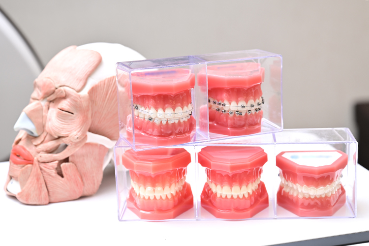 表参道AK歯科・矯正歯科 機能性だけでなく  横顔の美しさも重視した歯列矯正