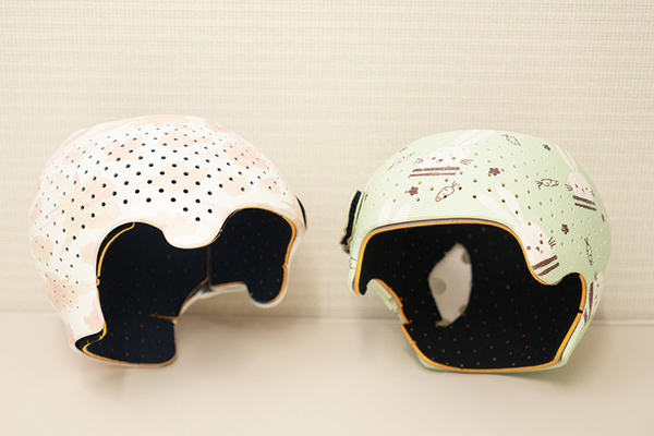 宮前平脳神経外科クリニック 乳児の頭の変形の改善を図るヘルメット治療 注意点と治療の流れ