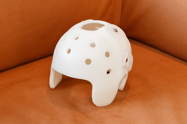 御影こども形成外科 赤ちゃんの頭の形が気になったら ヘルメット療法という選択肢も