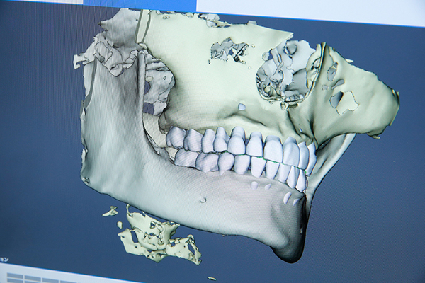 SEIJO PRIME DENTAL OFFICE 早さと精密さの両立をめざす デジタルを用いたインプラント治療