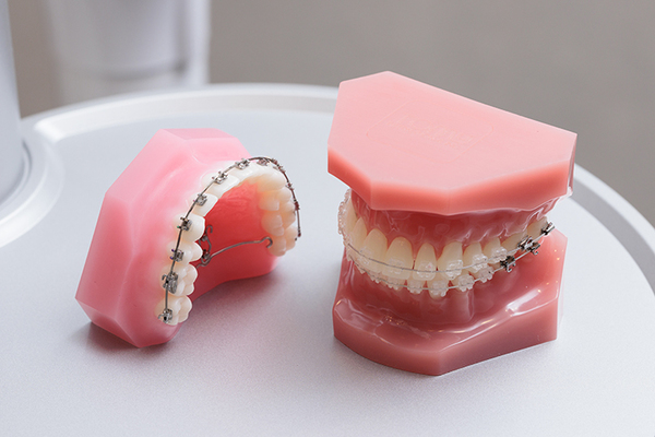 プラマデンタルクリニック成城 同院では成人矯正、小児矯正ともに対応している