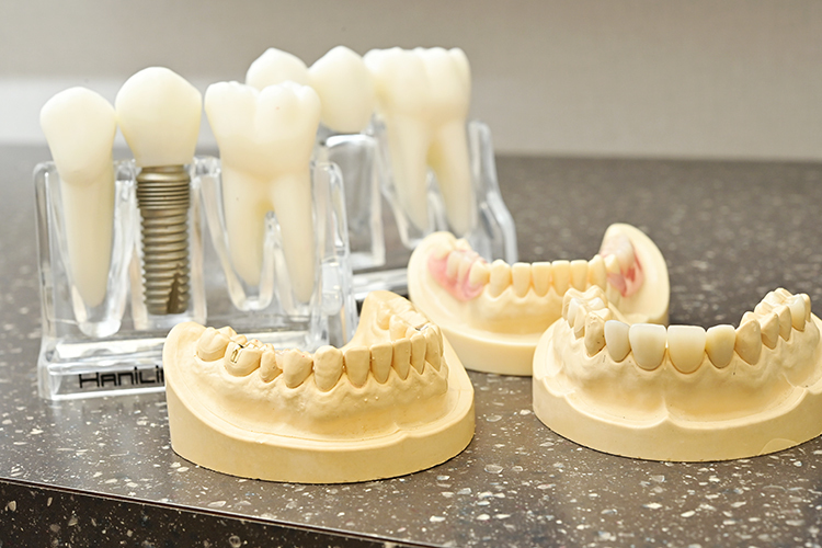 口が開けられない 開けると痛い 音がする 顎関節症の症状と治療 ドクターズ ファイル