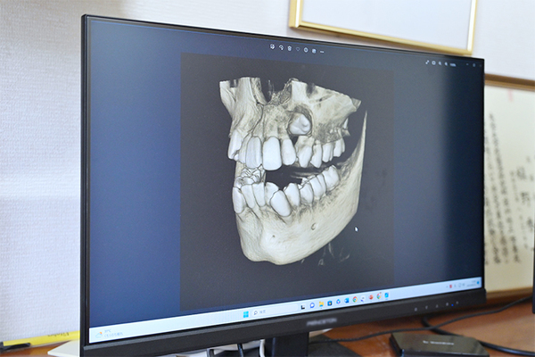 しゅういち矯正歯科クリニック 最も効率良く矯正治療が行えることが見込める装置を提案している