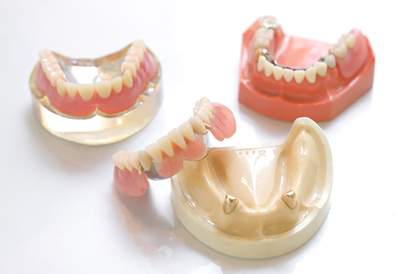 田中歯科 入れ歯の作製には複数回の通院と慣れる時間が必要